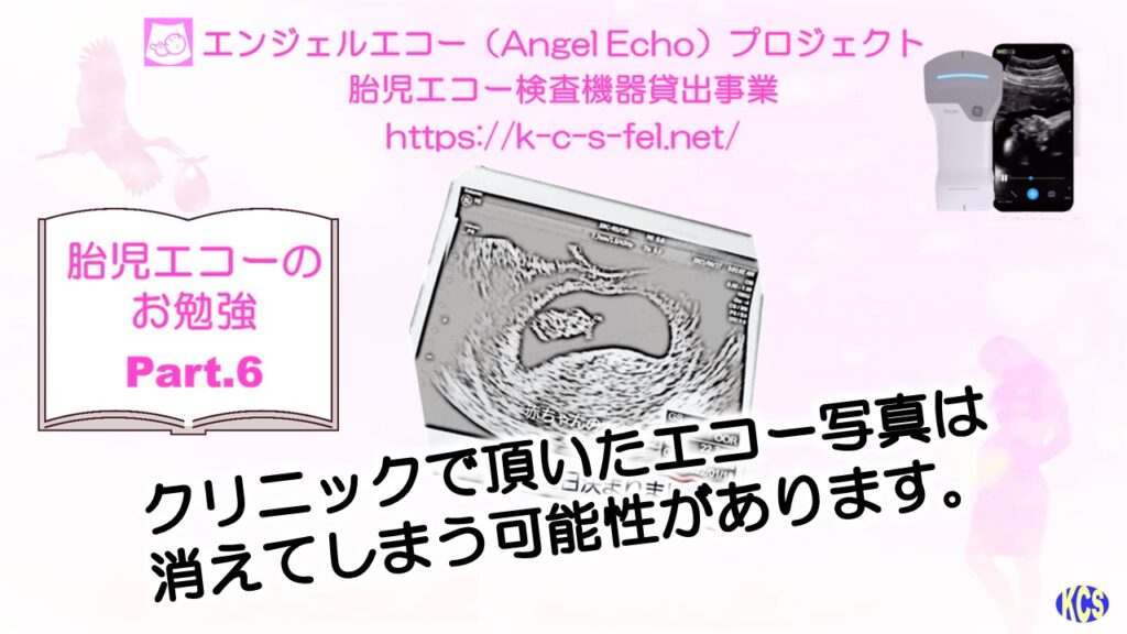 エコーのお勉強06