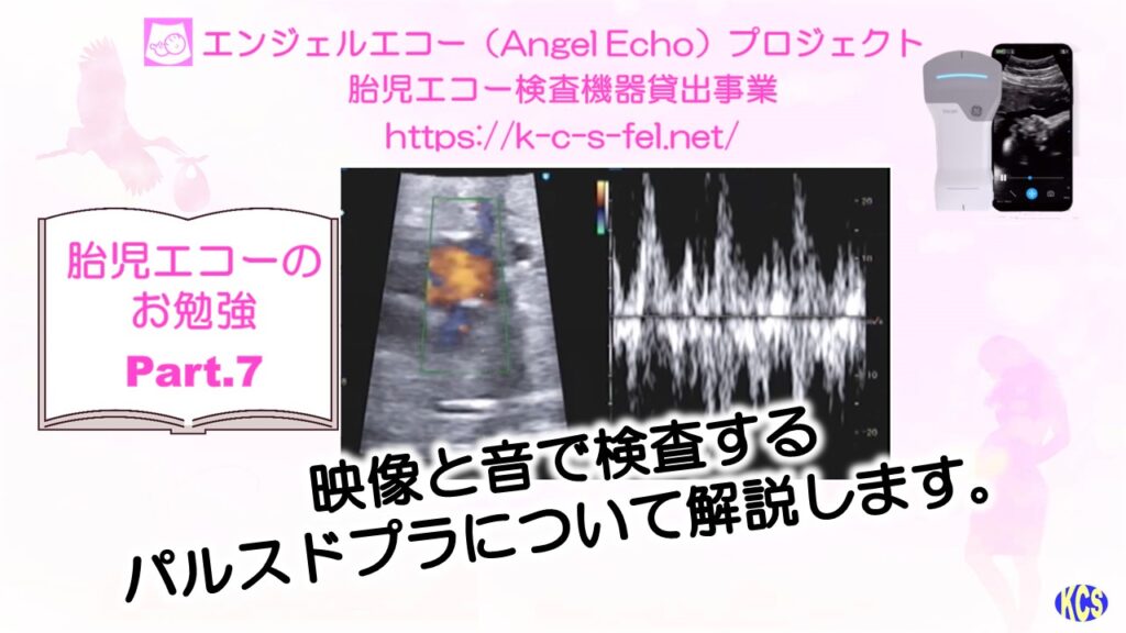 エコーのお勉強07