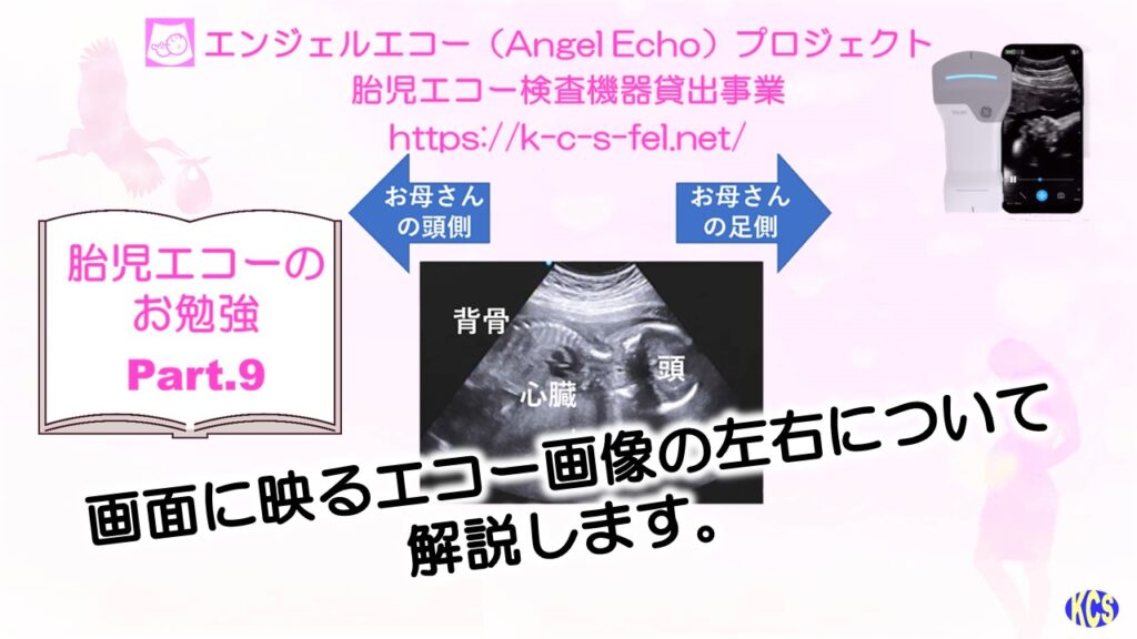 エコーのお勉強09