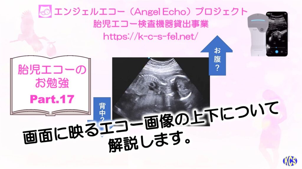 エコーのお勉強17